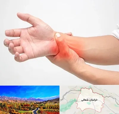 دکتر متخصص دست در خراسان شمالی