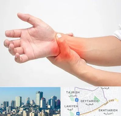 دکتر متخصص دست در قیطریه 