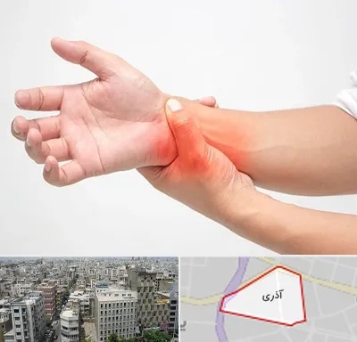 دکتر متخصص دست در آذری