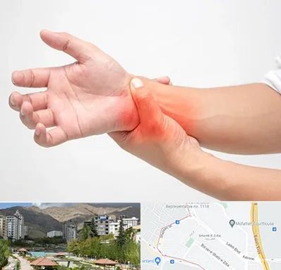 دکتر متخصص دست در شهر زیبا