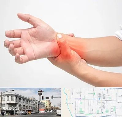 دکتر متخصص دست در 17شهریور