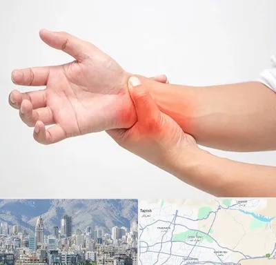 دکتر متخصص دست در شمال شرق تهران