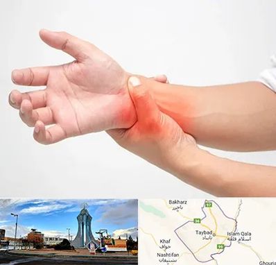 دکتر متخصص دست در تایباد