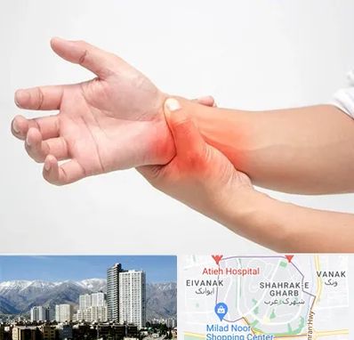 دکتر متخصص دست در شهرک غرب 