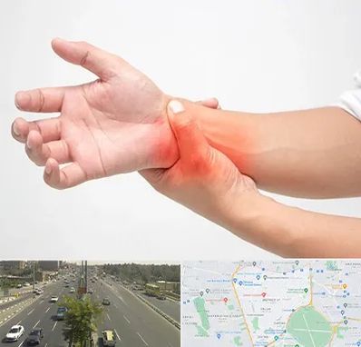 دکتر متخصص دست در منطقه 17 تهران 