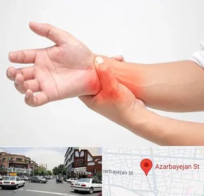 دکتر متخصص دست در خیابان آذربایجان