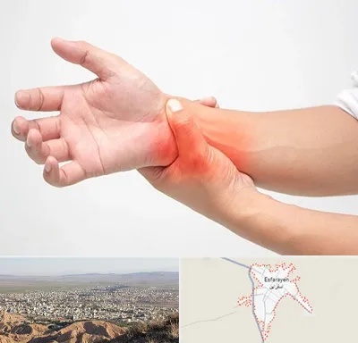 دکتر متخصص دست در اسفراین