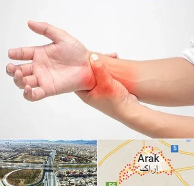 دکتر متخصص دست در اراک