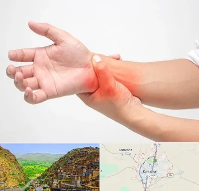 دکتر متخصص دست در کامیاران