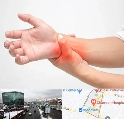 دکتر متخصص دست در اقدسیه 