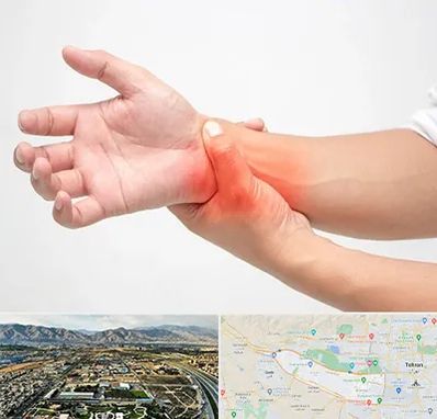 دکتر متخصص دست در منطقه 21 تهران