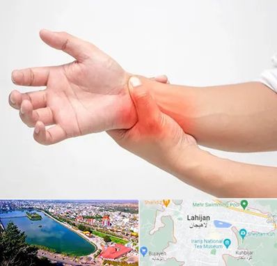 دکتر متخصص دست در لاهیجان