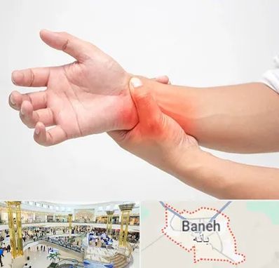 دکتر متخصص دست در بانه