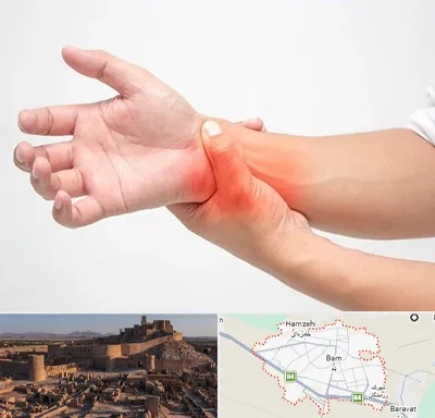 دکتر متخصص دست در بم
