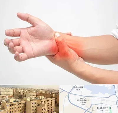 دکتر متخصص دست در جنوب غرب تهران