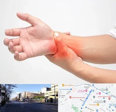 دکتر متخصص دست در خیابان ملاصدرا شیراز 