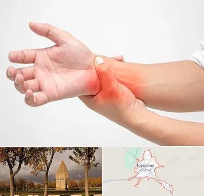 دکتر متخصص دست در تویسرکان