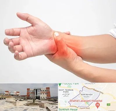 دکتر متخصص دست در حکیمیه