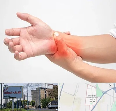 دکتر متخصص دست در فاز یک اندیشه