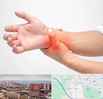 دکتر متخصص دست در سهند تبریز