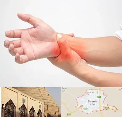 دکتر متخصص دست در ساوه