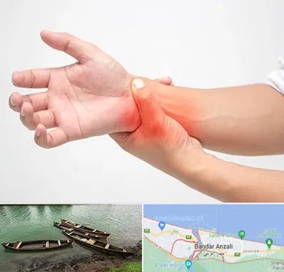 دکتر متخصص دست در بندر انزلی