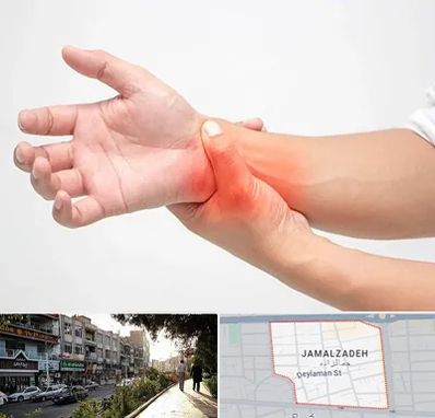 دکتر متخصص دست در خیابان جمالزاده