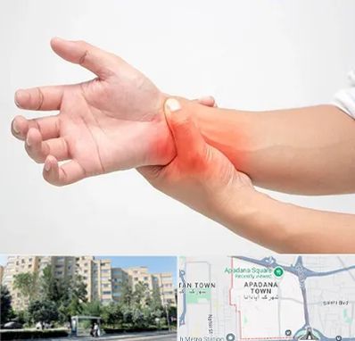 دکتر متخصص دست در آپادانا