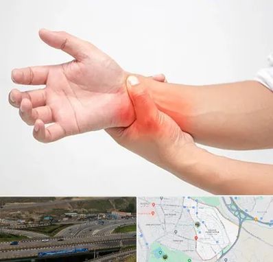 دکتر متخصص دست در یاغچیان تبریز