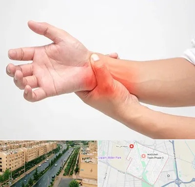 دکتر متخصص دست در فاز سه اندیشه