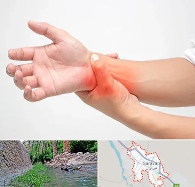 دکتر متخصص دست در سراوان