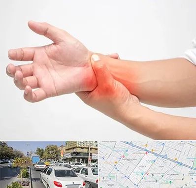 دکتر متخصص دست در مفتح مشهد 