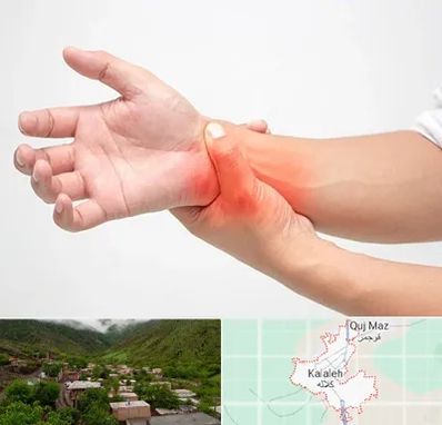 دکتر متخصص دست در کلاله