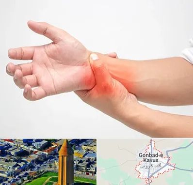 دکتر متخصص دست در گنبد کاووس