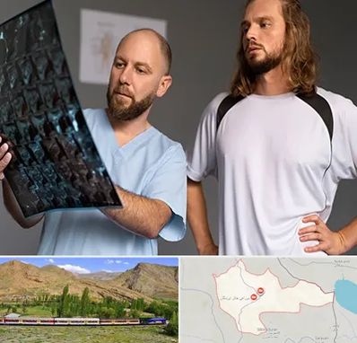 دکتر متخصص اسکلت بدن در خاش