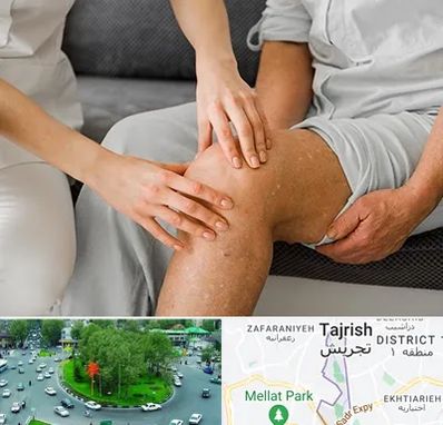 دکتر متخصص استئومیلیت در تجریش 