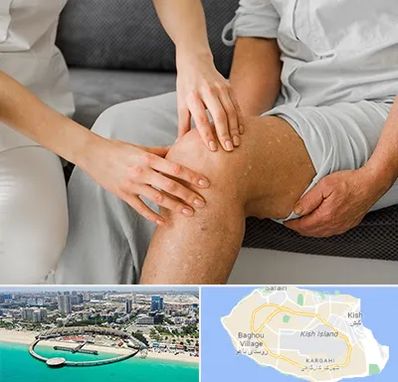 دکتر متخصص استئومیلیت در کیش