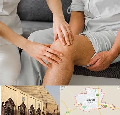 دکتر متخصص استئومیلیت در ساوه