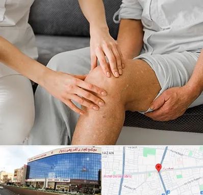 دکتر متخصص استئومیلیت در نصف راه تبریز