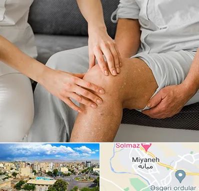 دکتر متخصص استئومیلیت در میانه