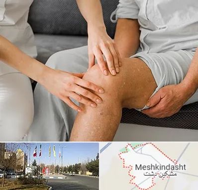 دکتر متخصص استئومیلیت در مشکین دشت