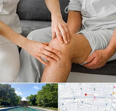 دکتر متخصص استئومیلیت در هشت بهشت اصفهان 