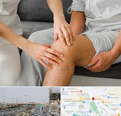 دکتر متخصص استئومیلیت در بلوار توس مشهد 