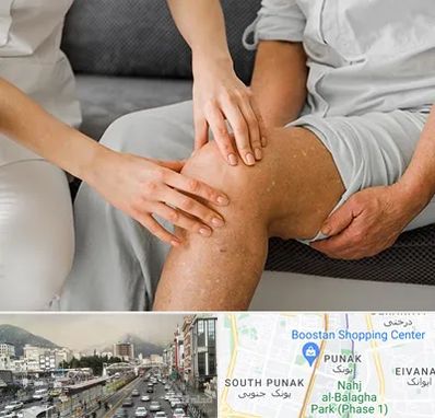 دکتر متخصص استئومیلیت در پونک 