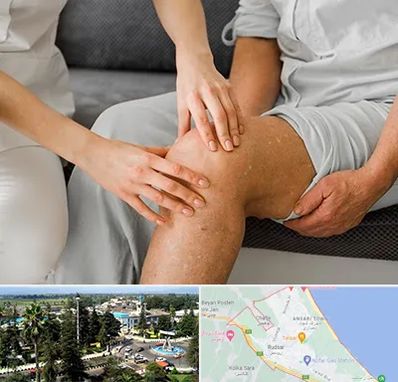 دکتر متخصص استئومیلیت در رودسر