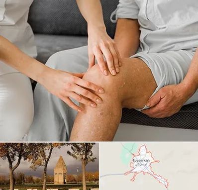 دکتر متخصص استئومیلیت در تویسرکان