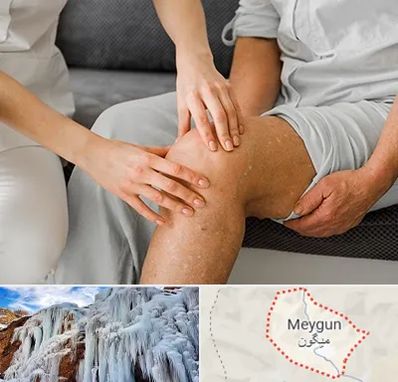 دکتر متخصص استئومیلیت در میگون