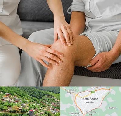 دکتر متخصص استئومیلیت در قائم شهر