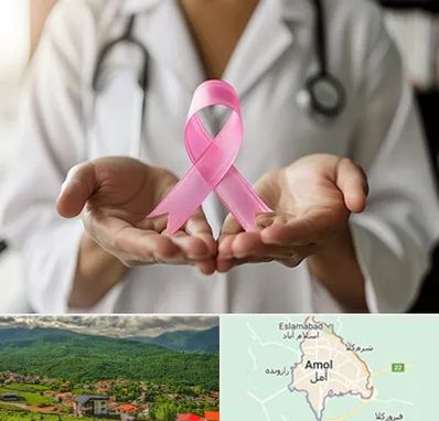 دکتر سرطان پستان در آمل
