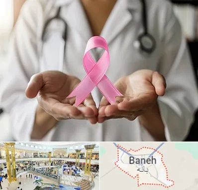 دکتر سرطان پستان در بانه